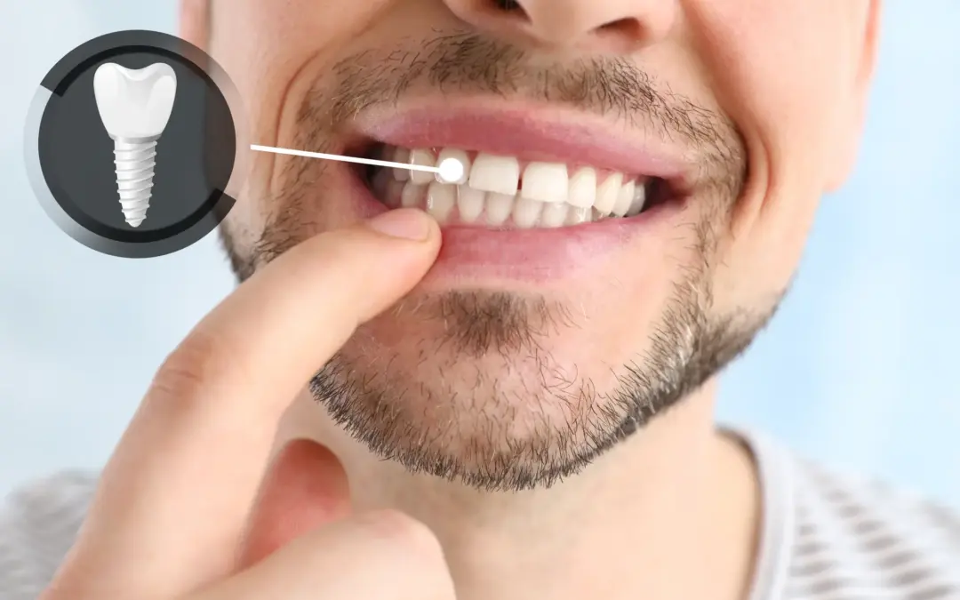 Am I a Candidate for Dental Implants If I Have Bone Loss or Gum Disease?